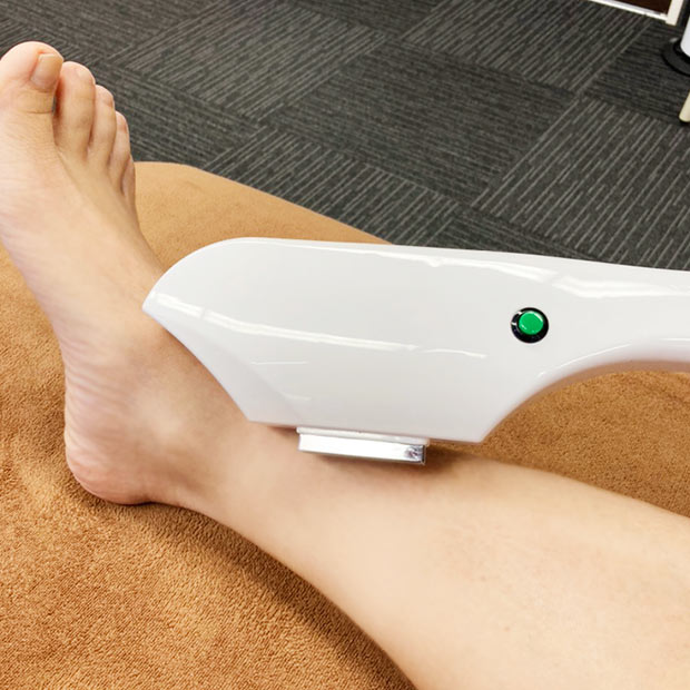 セルフ脱毛スタート